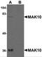 N(Alpha)-Acetyltransferase 35, NatC Auxiliary Subunit antibody, 5271, ProSci, Western Blot image 