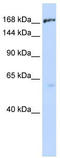ATP Binding Cassette Subfamily C Member 1 antibody, TA332082, Origene, Western Blot image 