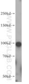 Zinc finger protein GLI2 antibody, 18989-1-AP, Proteintech Group, Western Blot image 