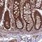 Coiled-Coil Domain Containing 125 antibody, PA5-59768, Invitrogen Antibodies, Immunohistochemistry paraffin image 