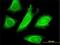 Staufen Double-Stranded RNA Binding Protein 1 antibody, H00006780-M03, Novus Biologicals, Immunocytochemistry image 