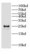 Casein kinase II subunit beta antibody, FNab01282, FineTest, Western Blot image 