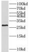 Homeobox protein Hox-B7 antibody, FNab03978, FineTest, Western Blot image 