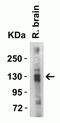 Angiotensin I Converting Enzyme 2 antibody, GTX15349, GeneTex, Western Blot image 