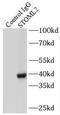 Stomatin-like protein 2 antibody, FNab08346, FineTest, Immunoprecipitation image 