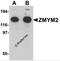 Zinc Finger MYM-Type Containing 2 antibody, 6135, ProSci, Western Blot image 