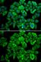 Oxoglutarate Dehydrogenase antibody, GTX33374, GeneTex, Immunofluorescence image 