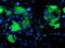 LIM domain kinase 1 antibody, LS-C173129, Lifespan Biosciences, Immunofluorescence image 