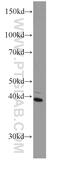 Bardet-Biedl Syndrome 5 antibody, 66136-1-Ig, Proteintech Group, Western Blot image 