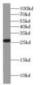 Glutathione S-Transferase Theta 2B (Gene/Pseudogene) antibody, FNab03702, FineTest, Western Blot image 
