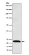 Inducible T Cell Costimulator antibody, M00291-1, Boster Biological Technology, Western Blot image 