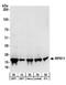 Ribosomal Protein S11 antibody, A303-937A, Bethyl Labs, Western Blot image 