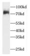 HECT Domain And Ankyrin Repeat Containing E3 Ubiquitin Protein Ligase 1 antibody, FNab03745, FineTest, Western Blot image 