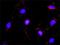 CRK Like Proto-Oncogene, Adaptor Protein antibody, H00001399-M03, Novus Biologicals, Proximity Ligation Assay image 