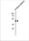 Fibrinogen Gamma Chain antibody, TA324922, Origene, Western Blot image 