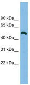 Zinc Finger Protein 829 antibody, TA339657, Origene, Western Blot image 