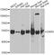 Aspartyl-TRNA Synthetase antibody, A6574, ABclonal Technology, Western Blot image 