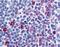 C-C chemokine receptor type 8 antibody, NLS359, Novus Biologicals, Immunohistochemistry paraffin image 