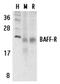 CD268 antibody, SP2134P, Origene, Western Blot image 