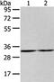 Zinc Finger Protein 146 antibody, PA5-51343, Invitrogen Antibodies, Western Blot image 