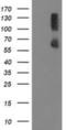 Protein Phosphatase, Mg2+/Mn2+ Dependent 1G antibody, NBP2-03463, Novus Biologicals, Western Blot image 