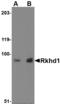 Mex-3 RNA Binding Family Member D antibody, MBS150994, MyBioSource, Western Blot image 