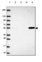UDP-Glucose Pyrophosphorylase 2 antibody, HPA064836, Atlas Antibodies, Western Blot image 
