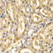 ADH4 antibody, 19-673, ProSci, Immunohistochemistry paraffin image 