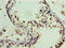 P27 antibody, A56755-100, Epigentek, Immunohistochemistry paraffin image 