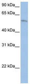 FAM20C Golgi Associated Secretory Pathway Kinase antibody, TA338410, Origene, Western Blot image 