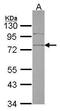 Sushi Repeat Containing Protein X-Linked antibody, TA308135, Origene, Western Blot image 