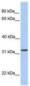 SLG antibody, TA342078, Origene, Western Blot image 