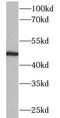 Cytochrome P450 Family 2 Subfamily A Member 6 antibody, FNab02155, FineTest, Western Blot image 