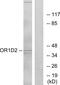 Olfactory Receptor Family 1 Subfamily D Member 2 antibody, GTX87656, GeneTex, Western Blot image 