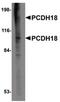 Protocadherin-18 antibody, PA5-20704, Invitrogen Antibodies, Western Blot image 