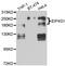 Eukaryotic translation initiation factor 4 gamma 1 antibody, abx007344, Abbexa, Western Blot image 