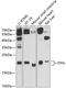 Inosine Triphosphatase antibody, 14-317, ProSci, Western Blot image 