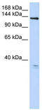Anoctamin-3 antibody, TA339580, Origene, Western Blot image 