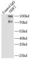Outer dense fiber protein 2 antibody, FNab05971, FineTest, Immunoprecipitation image 