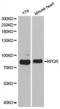 X-linked retinitis pigmentosa GTPase regulator antibody, A1844, ABclonal Technology, Western Blot image 