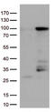 EWS RNA Binding Protein 1 antibody, TA813054, Origene, Western Blot image 