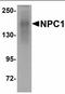Niemann-Pick C1 protein antibody, orb95537, Biorbyt, Western Blot image 