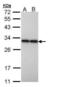 Phosphoglycerate Mutase 2 antibody, PA5-22038, Invitrogen Antibodies, Western Blot image 