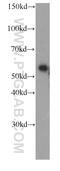 Alpha-2-HS-glycoprotein antibody, 66094-1-Ig, Proteintech Group, Western Blot image 