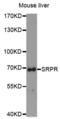 SRP Receptor Subunit Alpha antibody, abx004555, Abbexa, Western Blot image 