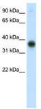 E2F Transcription Factor 3 antibody, TA335211, Origene, Western Blot image 