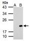 p21 antibody, GTX112898, GeneTex, Western Blot image 