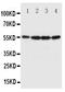Fascin Actin-Bundling Protein 1 antibody, PA1575, Boster Biological Technology, Western Blot image 