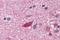 Muscarinic acetylcholine receptor M3 antibody, NLS5259, Novus Biologicals, Immunohistochemistry paraffin image 