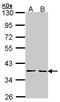 Chitinase 3 Like 2 antibody, LS-C185595, Lifespan Biosciences, Western Blot image 